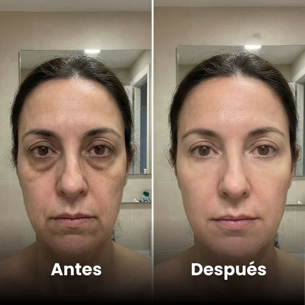 Ojeras